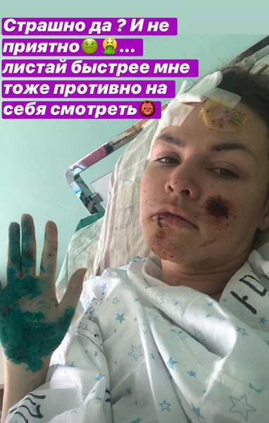 Попавшая в ДТП вице-мисс «Краса России» перенесла клиническую смерть